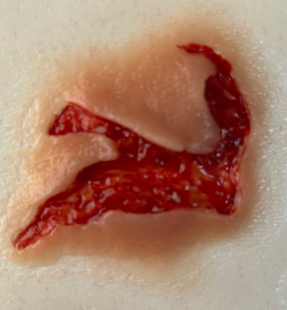 Pre-painted Wound Appliance